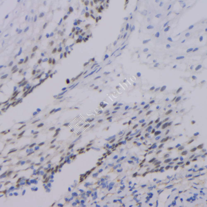 02 GB12900_P63_2H5A7_20230517_d1000_H tonsils_IHC_WM.png
