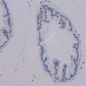 04 GB12900_P63_2H5A7_20230517_d1000_M prostate_IHC_WM.png
