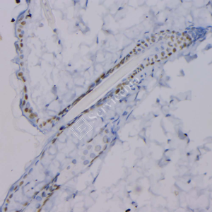 05 GB12900_P63_2H5A7_20230517_d1000_M skin_IHC_WM.png