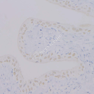 06 GB12900_P63_2H5A7_20230517_d1000_R bladder_IHC_WM.png