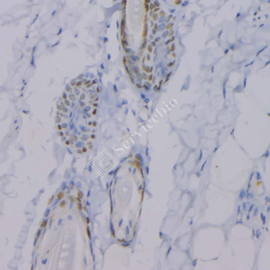 07 GB12900_P63_2H5A7_20230517_d1000_R skin_IHC_WM.png