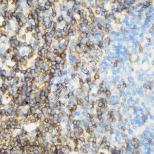 02 GB15014_CD3_ZCM22138_ZCM22138230725_d1000_H tonsil_40.0x_IHC_WM.png