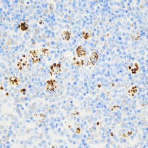 03 GB15186_TLR4_ZCM17020_ZCM17020230823_d1000_M Inflammatory model induced by lps(6h) spleen_40.0x_IHC_WM.png
