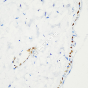 01 GB15396_P63_ZCM21075_ZCM21075230717_d1000_M skin_40.0x_IHC_WM.png