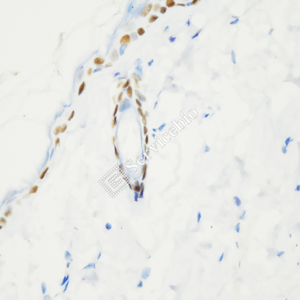 02 GB15396_P63_ZCM21075_ZCM21075230717_d1000_R skin_40.0x_IHC_WM.png