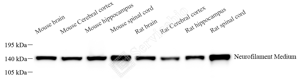 01 GB15763_160 kDa Neurofilament Medium_重组H208_d1000_WB_WM.png