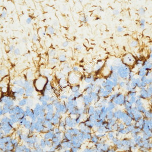 02 GB15763_160 kDa Neurofilament Medium_ZSM20006_ZSM20006230725A_d1000_R Brain_40.0x_IHC_WM.png