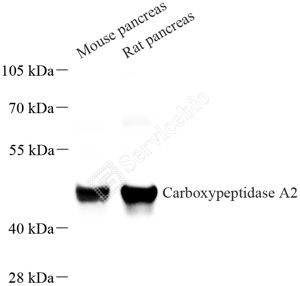 01 GB115624_Carboxypeptidase A2_1134521051902_d2000_WB_WM.png