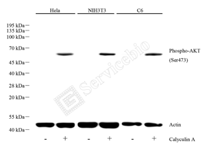 01 GB150002_Phospho-AKT(Ser473)_重组H299_d8000_WB_WM.png