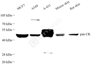 01 GB152050_Acidic Cytokeratin_重组H229_d1000_WB_WM.png