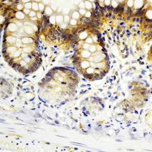 04 GB15540_Caspase-7_ZCM22009_ZCM22009230824_d1000_R_small intestine_40.0x_IHC-WM.png