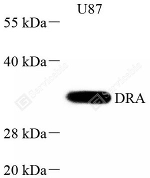 01 GB115643_HLA-DR_697720050802_d500_WB-WM.png