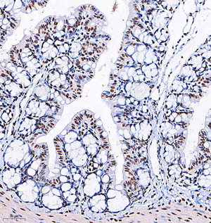 03 GB153380_Phospho-p38_H283_M008230825_d500_M small intestine_20.0x_IHC.png