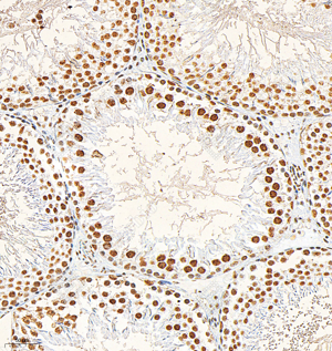 07 GB153380_Phospho-p38_H283_M008230825_d500_R testis_20.0x_IHC.png