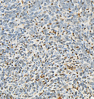 08 GB154685_P38_H298_M007230902_d500_M subcutaneous nude mouse model of 4T1 cell_28.3x_IHC.-WM.png