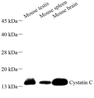 01 GB111376_4628 Cystatin-C_WB.png