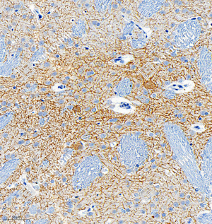 02 GB12011_Acetylcholinesterase_5D6D10_5D6D10 20231024_d1000_R Seahorses_40.0x_IHC_WM.png