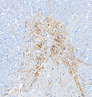 03 GB12011_Acetylcholinesterase_5D6D10_5D6D10 20231024_d1000_R Spinal cord_40.0x_IHC_WM.png