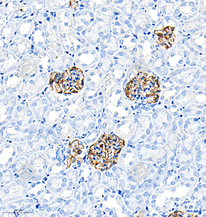 01 GB12343_Nephrin_7C4D4_7C4D4 20231024_d1000-3000_M_kidney_28.3.0x_IHC_WM.png