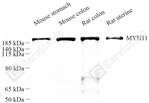 01 GB15011_smooth muscle Myosin heavy chain 11_重组 H312_d1000_WB_WM.png