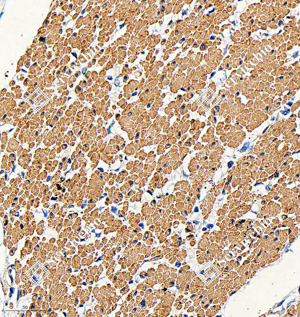 03 GB15011_smooth muscle Myosin heavy chain 11_R20004_(A363 364)_d1000_H smooth muscle_31.2x_IHC_WM.png