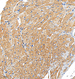 05 GB15011_smooth muscle Myosin heavy chain 11_R20004_(A363 364)_d1000_M heart_20.0x_IHC_WM.png