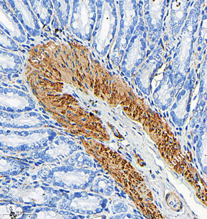 06 GB15011_smooth muscle Myosin heavy chain 11_R20004_(A363 364)_d1000_R colon_31.5x_IHC_WM.png