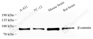 01 GB15016_beta Catenin_重组 H312_d1000_WB_WM.png