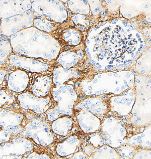 02 GB15091_Fibronectin_M19103（A209 210)__d1000_H kidney_26.2x_IHC_WM.png