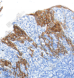 02 GB15801_Cytokeratin 13_M21109_A304_A305_d1000_H tonsil_25.9x_IHC_WM.png