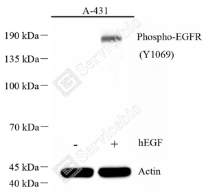 01 GB115662_Phospho-EGFR(Y1069)_P-C2958-02_d300_WB_WM.png