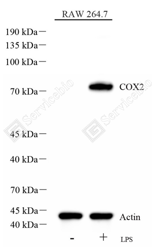 01 GB115672_COX2  Cyclooxygenase 2__d2000_WB_WM.png