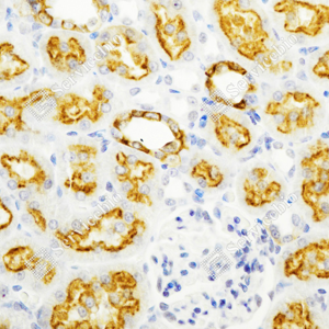 03 GB15231_Cytokeratin 8_ZSM21106_ZSM21106231106A_d500_M kidney_40.0x_IHC_WM.png