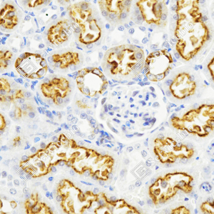 04 GB15231_Cytokeratin 8_ZSM21106_ZSM21106231106A_d500_R kidney_40.0x_IHC_WM.png