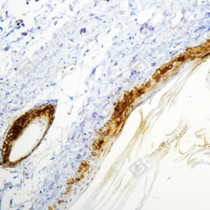 01 GB15800_Cytokeratin 6_ZSM19025_ZSM19025231107_d500_M skin_20.0x_IHC_WM.png