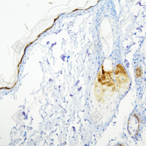 02 GB15800_Cytokeratin 6_ZSM19025_ZSM19025231107_d500_R skin_20.0x_IHC_WM.png