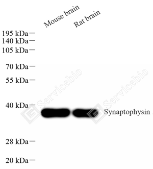 01 GB15814_synaptophysin_重组 H388_d 0.2ug per mL_WB_WM.png