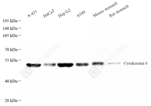 01 GB15823_Cytokeratin 6_重组 H377_d 1ug per mL_WB_WM.png