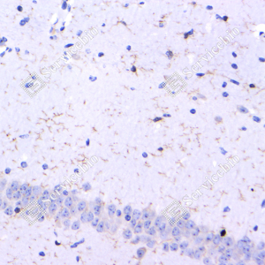 02 GB115689_CD11b-C3211-C321123070402_d500_M brain from MACO model_40.0x_IHC_WM.png