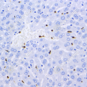 03 GB115689_CD11b-C3211-C321123070402_d500_M Inflammatory model induced by lps(6h) liver_40.0x_IHC_WM.png