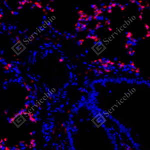 07 GB115689_CD11b red_C3211_C321123070402_d500_M Inflammatory model induced by lps(24h) lung_20.0x_IF_WM.png