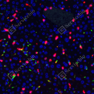 08 GB115689 _20231221_CD11B_red_C3211_C321123070402 d500&GB113109_CD68_green d200_M Inflammatory model induced by lps(24h) liver_20.0x_IF_WM.png