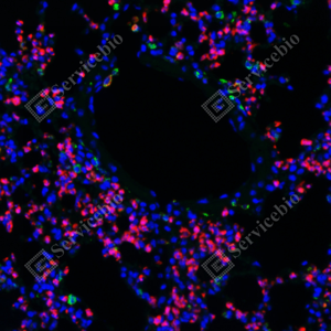 09  GB115689_20231221_CD11B_red_C3211_C321123070402 d500&GB113109_CD68_green d200_M Inflammatory model induced by lps(24h) lung_20.0x_IF_WM.png