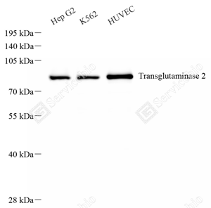 01 GB150005_Transglutaminase 2_重组 H373_d 1ug per mL_WB_WM.png