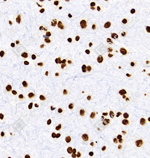 05 GB11102_Histone H3_C545_C54520111102_d500_R brain_40.0x-IHC_WM.png