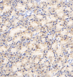 05  GB113133_20210410_IVD_9463_946320122302 R pancreas d2800_31.8x_IHC.png