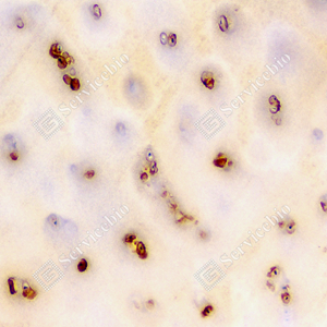 03  GB115687_Aggrecan_C3458_C345823082902_d1500_H bone_20.0x_IHC_WM - 副本.jpg