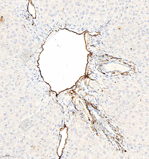 05 GB15013_CD34_M015_d100_R liver_20.0x_IHC_WM.png