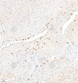 06 GB15058_CD11b_M018_d200_H liver_20.0x_IHC_WM.png