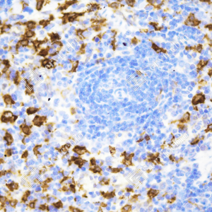 03 GB15104_Heme Oxygenase 1_ZCM18045_ZCM18045231211_d800_R Inflammatory model induced by lps(6h) spleen_40.0x_IHC_WM.png